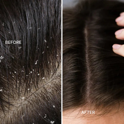 Electric Massager Comb