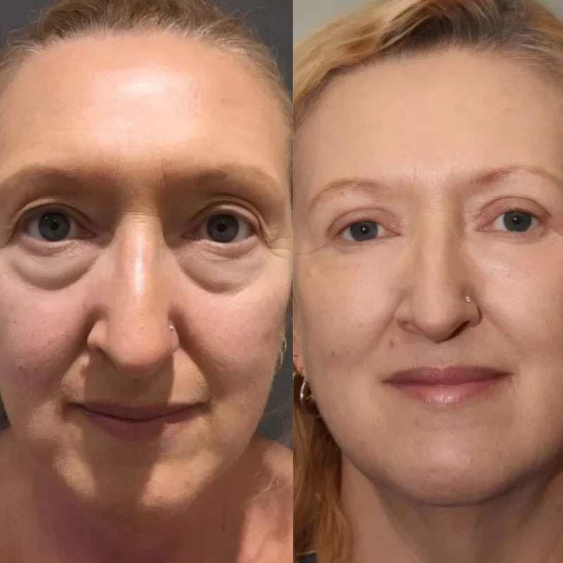 Facial Lifting Beauty Eye Pad