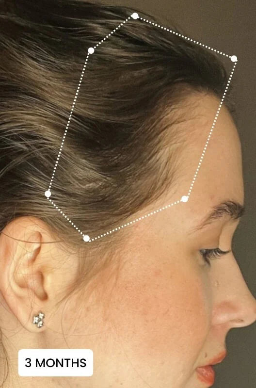 Electric Massager Comb