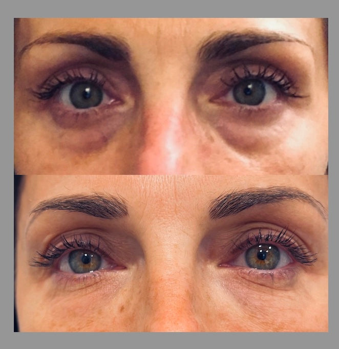 Facial Lifting Beauty Eye Pad