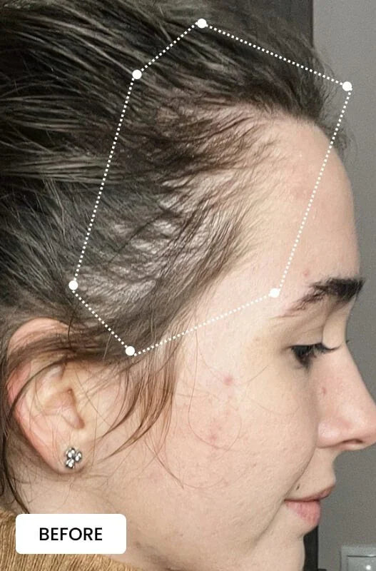 Electric Massager Comb